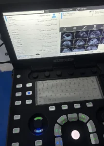 Equipo de ecografía veterinaria digital